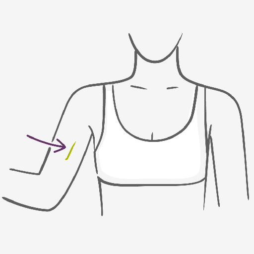 Como usar o Implante Contraceptivo